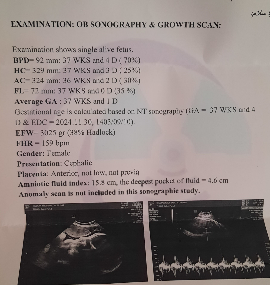 تفسیر سونوگرافی ۳۷ هفتگی