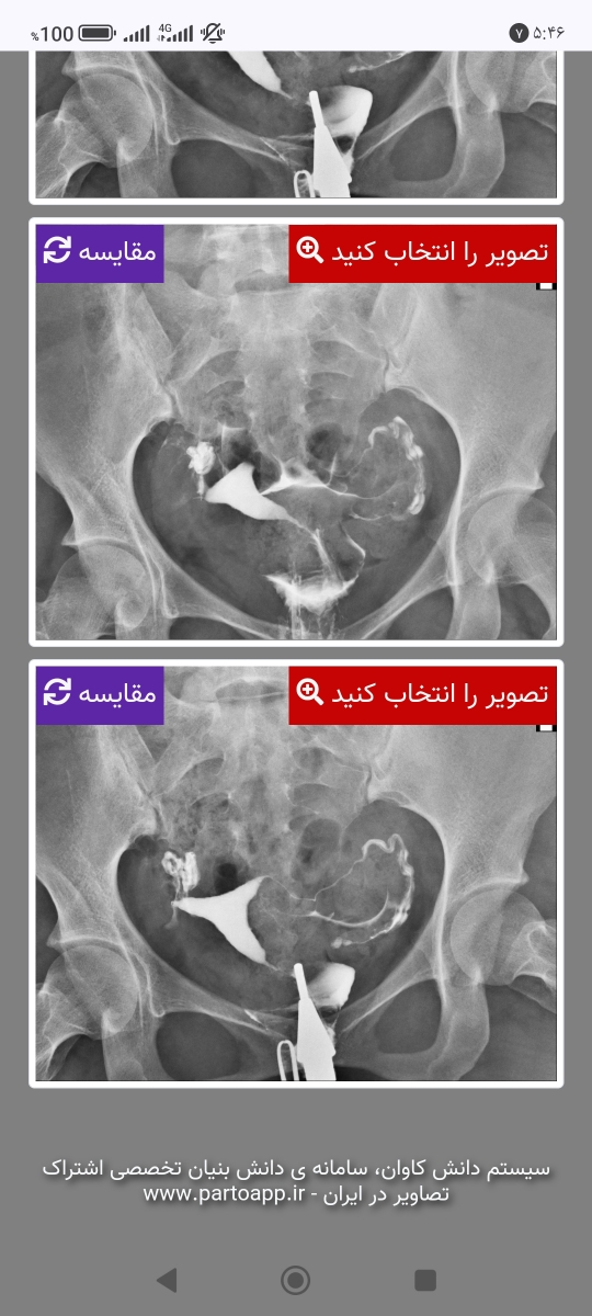 سلام سوال یکی از دوستامه عکس رنگی