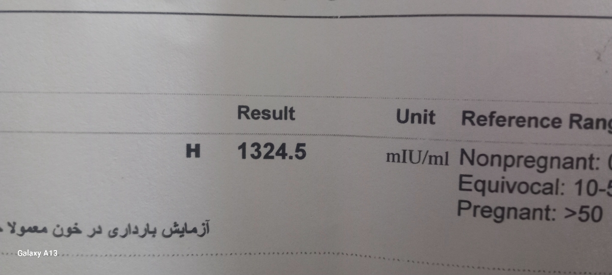 عدد بتا رو ببینید بی زحمت