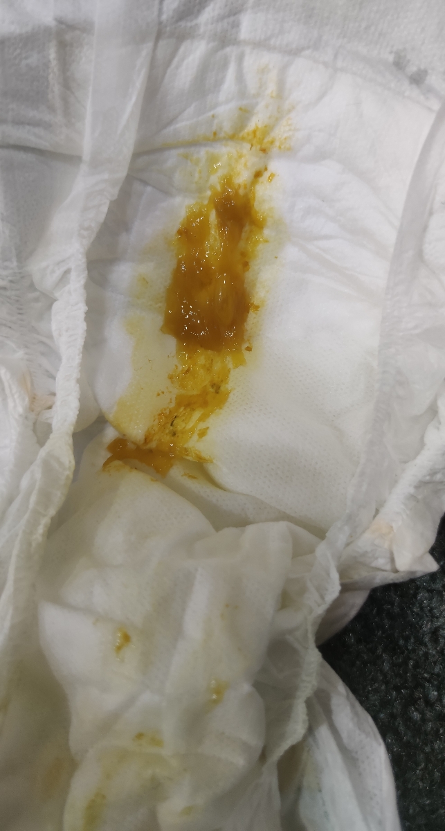 سلام دکتر جان داروهای رفلاکس پسرمو چک میکنید سلام دکتر جان داروهای رفلاکس پسرمو چک میکنید