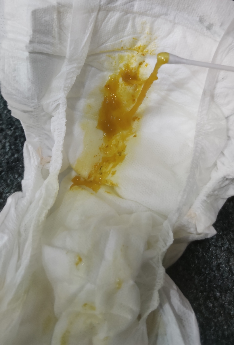 سلام دکتر جان داروهای رفلاکس پسرمو چک میکنید سلام دکتر جان داروهای رفلاکس پسرمو چک میکنید