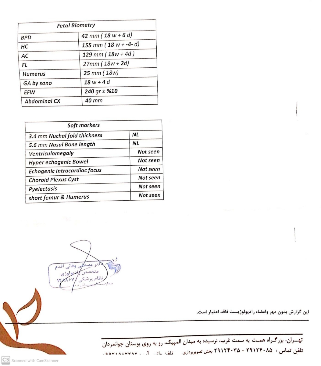 سونوگرافی آنومالی اسکن بارداری