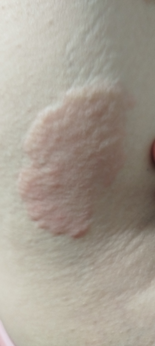 قرص شیرافزا و کهیرزدن قرص شیرافزا و کهیرزدن