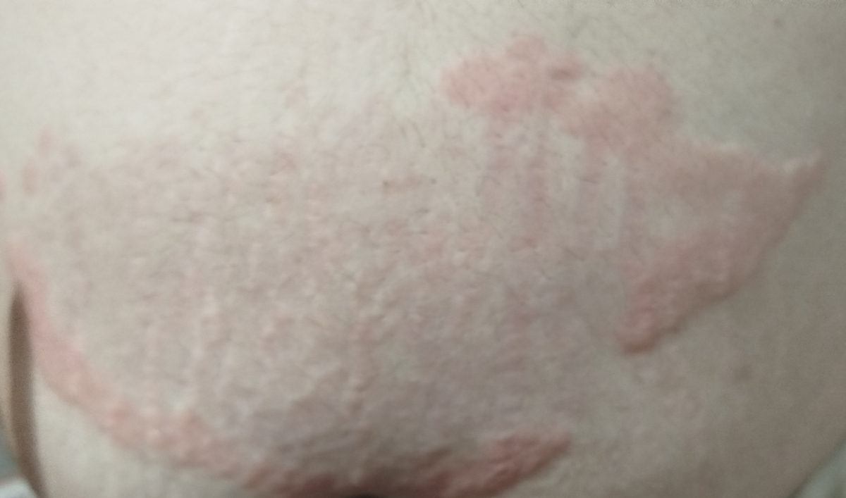 قرص شیرافزا و کهیرزدن قرص شیرافزا و کهیرزدن