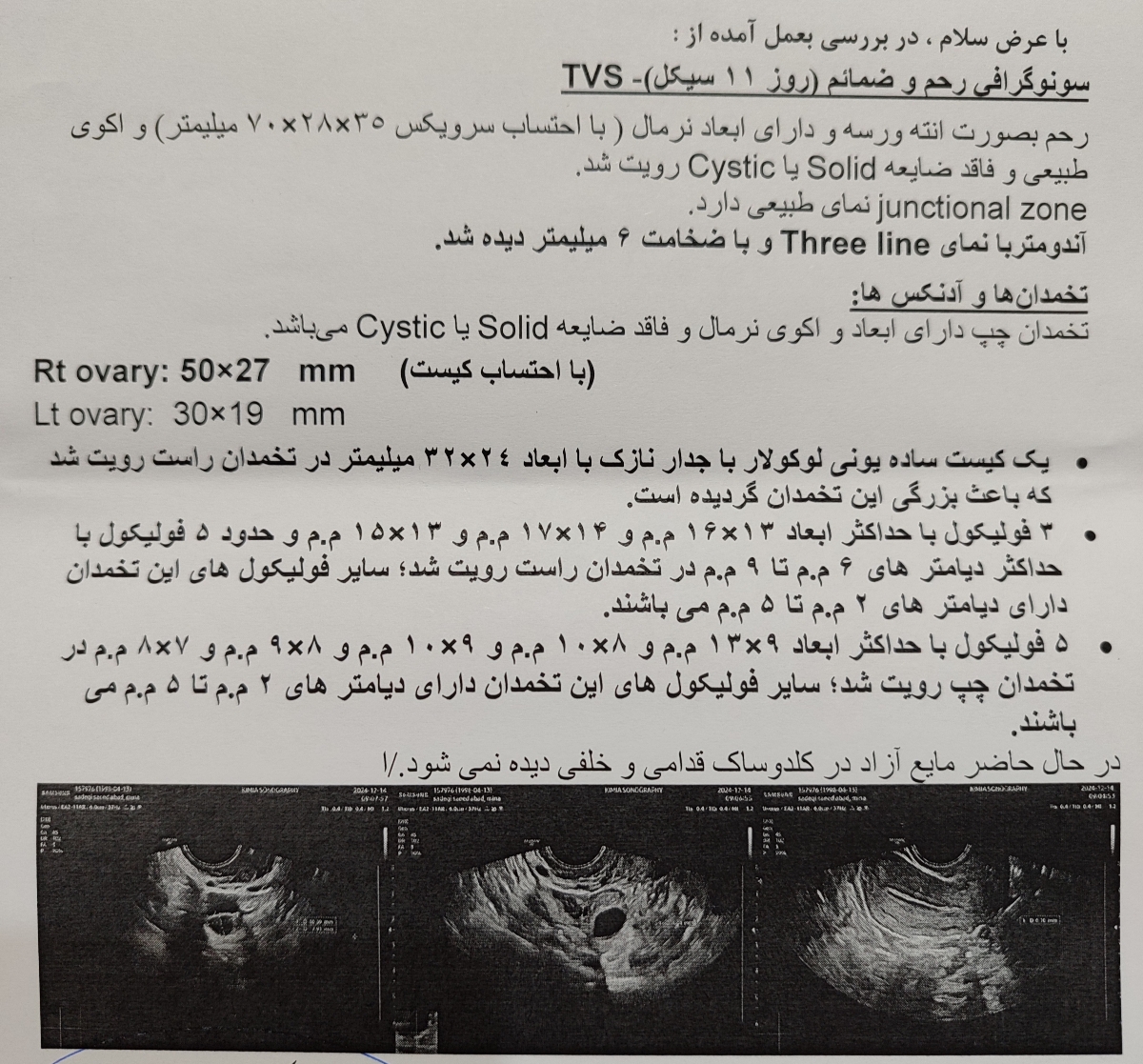 این برای امروزه