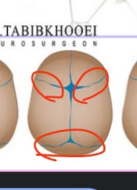 اون قسمتی ک قرمز کردم دقیقا همون خط های آبی رنگ برجسته س