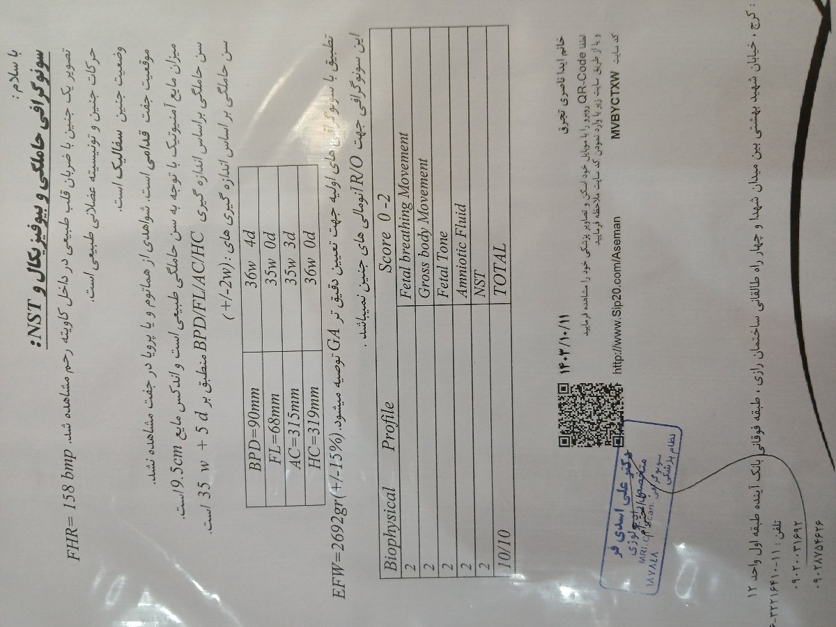 ورم پا در بارداری ورم پا در بارداری