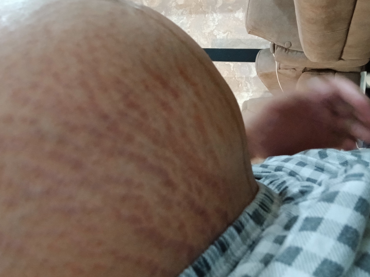 اینو از بغل انداختم دکترجان 