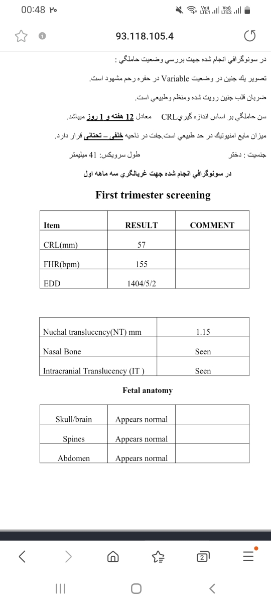 سونوی ان تی وجفت