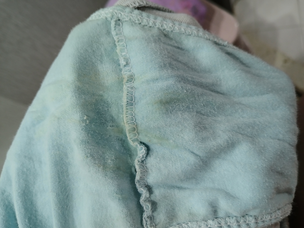 شرمنده بابت عکس دکترجان در کنار اینکه ترشح هست با آب میاد نرمال هست؟