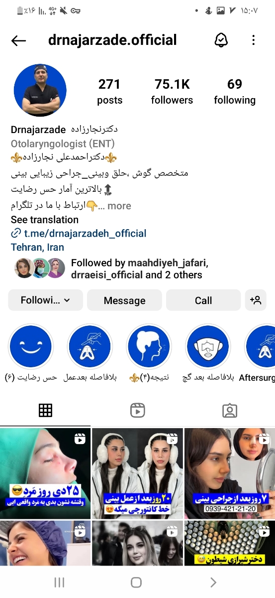 عمل زیبایی بینی درتهران و شمال