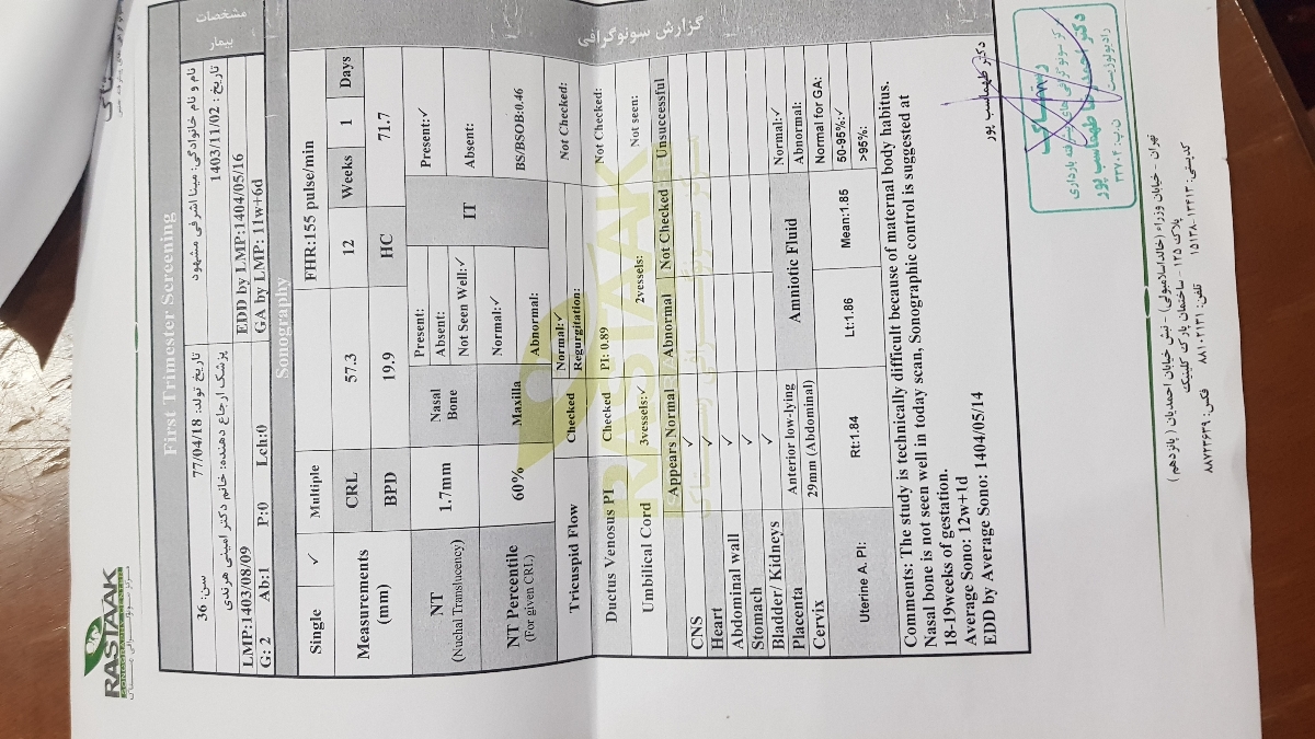 تفسیر ازمایش غربالگری هفته دوازده