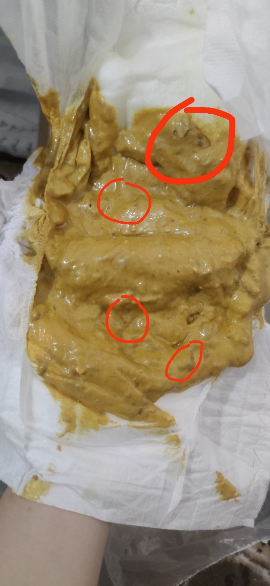 سلام خانم دکتر این بنظرتون خون یا عفونت