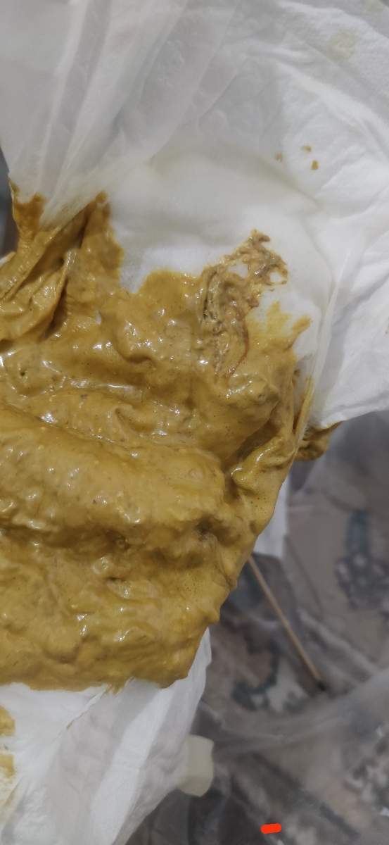 سلام خانم دکتر این بنظرتون خون یا عفونت