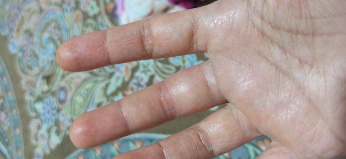 انگشتمو در قوطی بریده باد کرده