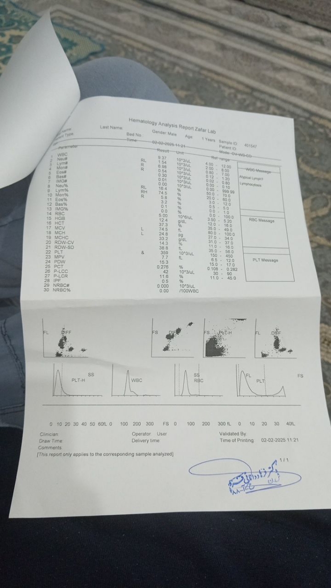 تفسیر آزمایش کودک ده ماهه