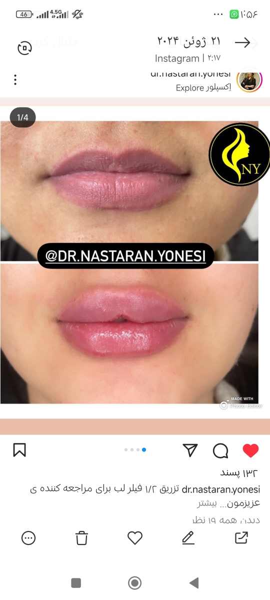 دوسال پیش 1 سی س زدم چقد قشنگه دوسال پیش 1 سی س زدم چقد قشنگه