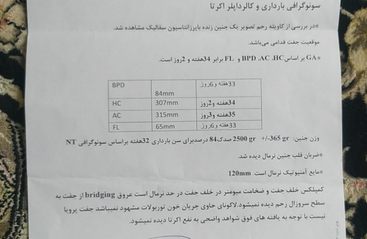 سونو امروز ۱۲/۱۵ 