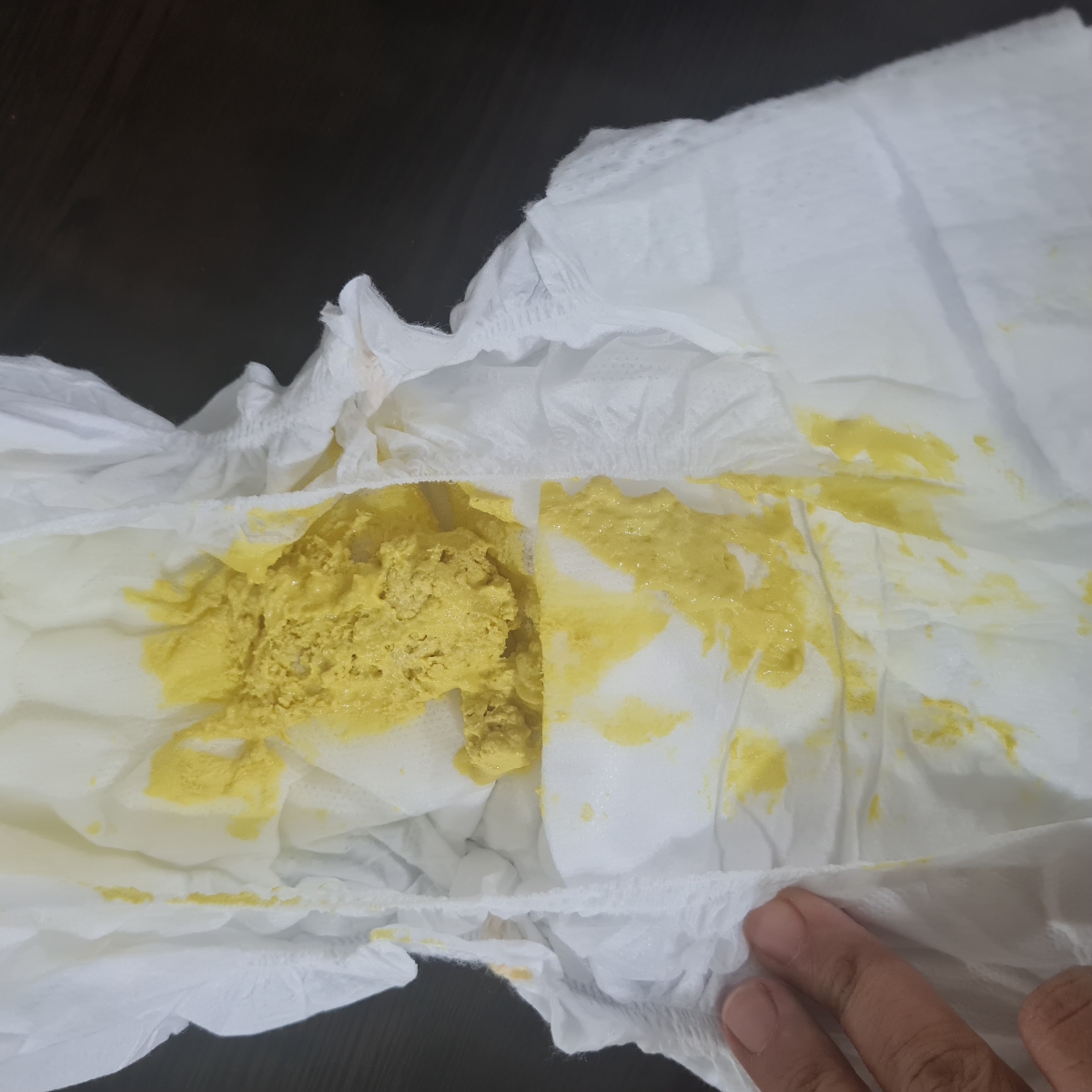 عکس مدفوع نوزاد اسهال و بی هالی