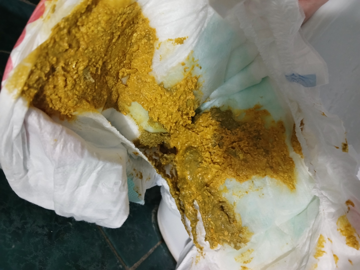این شکلی هست دکترجان شرمنده ام بابت عکس این شکلی هست دکترجان شرمنده ام بابت عکس