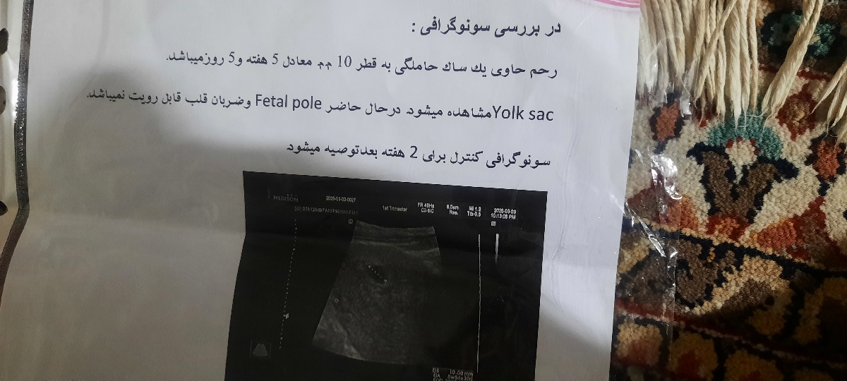مصرف پماد انتی همورییددر بارداری