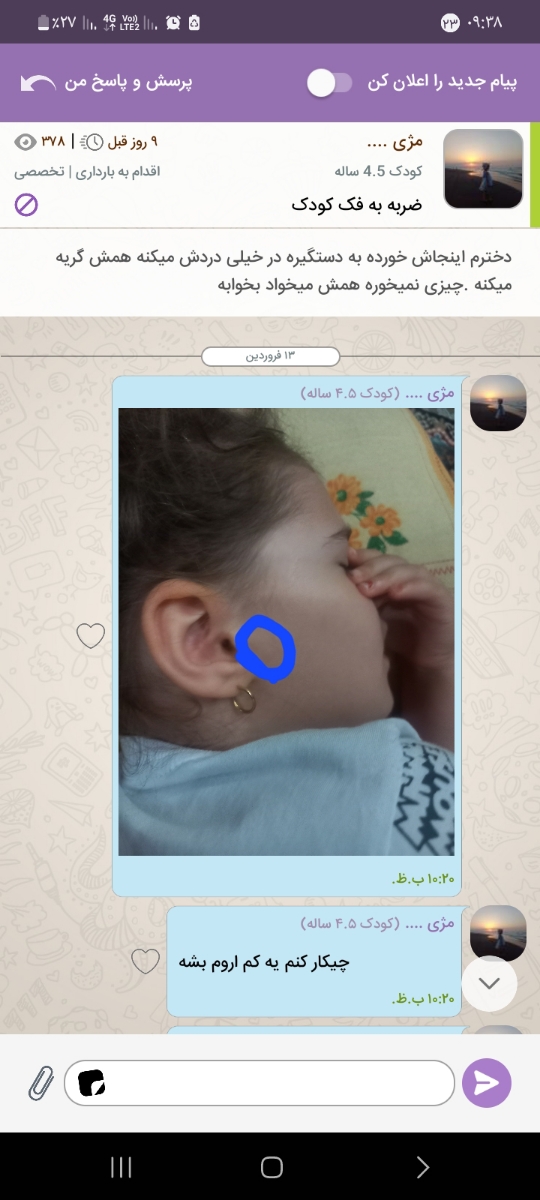 سلام .ضربه به گوش و مریض شدنش التهاب گوش دوبار دکتر بردم