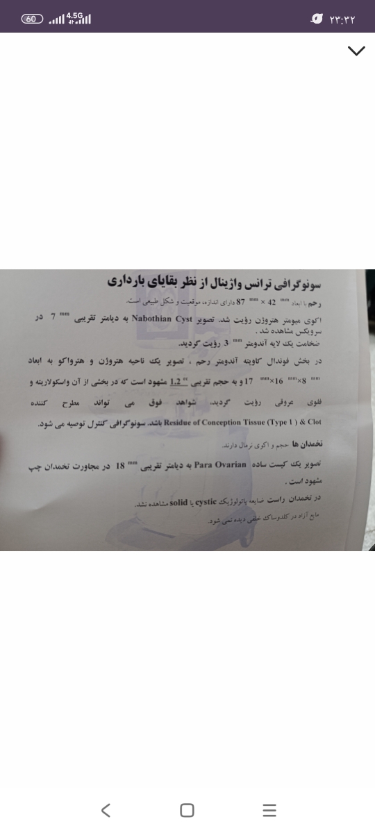سقط خوردن ال دی خونریزی سقط خوردن ال دی خونریزی