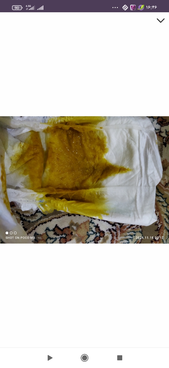 عکس مدفوع نوزاد ایا خلطی هست