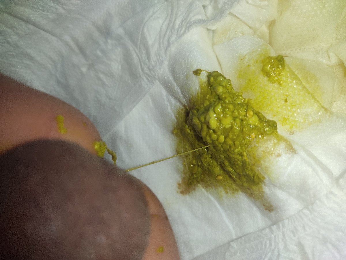 این اخرین دفعش بوده دیگه اونجوری اسهال نیست خانوم دکتر این اخرین دفعش بوده دیگه اونجوری اسهال نیست خانوم دکتر