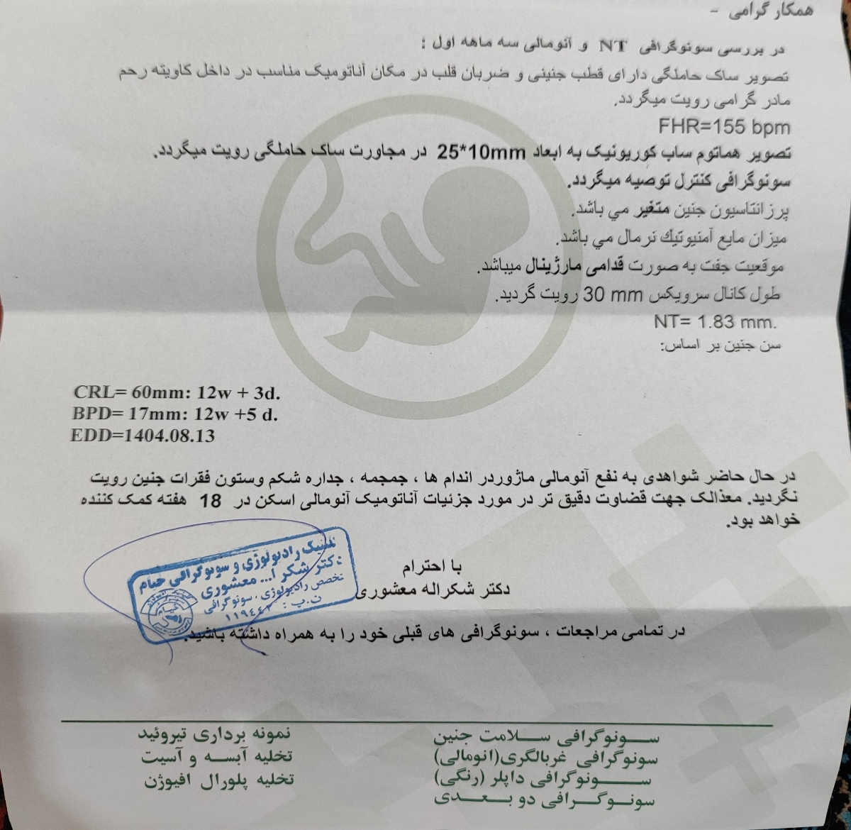 تفسیر سونو ان تی تفسیر سونو ان تی