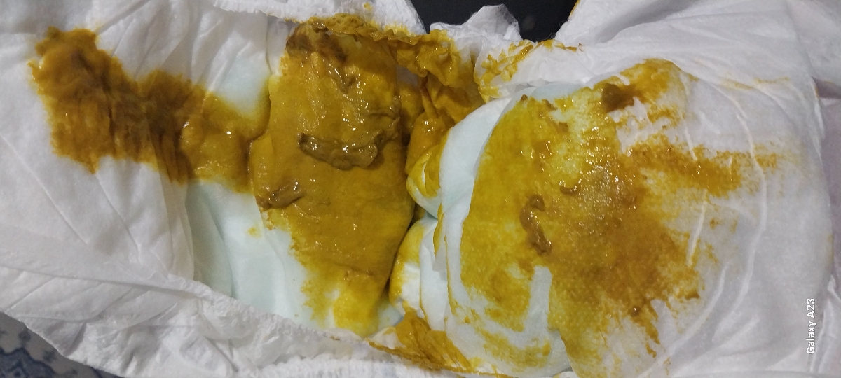 مدفوع نوزاد خلطی است؟ مدفوع نوزاد خلطی است؟