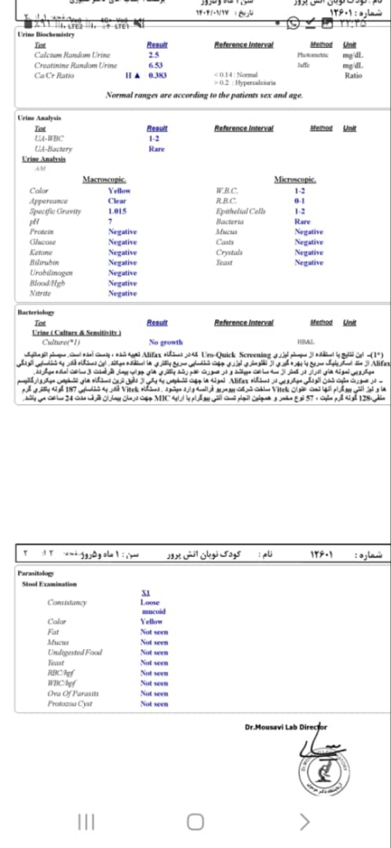 شیر خشک گیگوز و رفلاکس شیر خشک گیگوز و رفلاکس