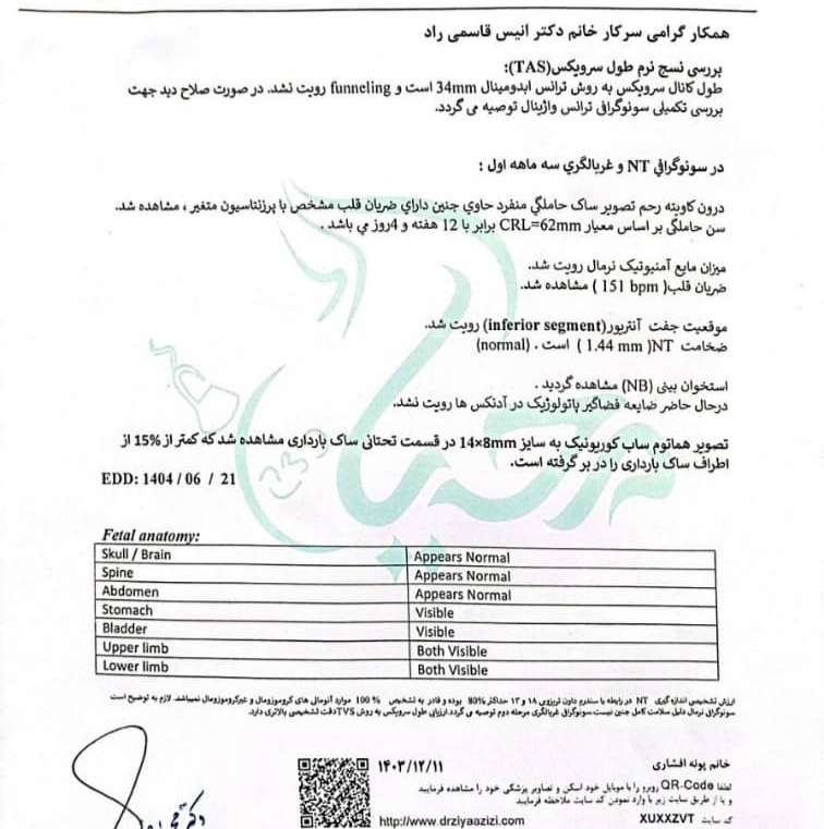 استخوان بینی کوتاه در آنومالی با جواب آزمایش سلفری بدون مشکل استخوان بینی کوتاه در آنومالی با جواب آزمایش سلفری بدون مشکل
