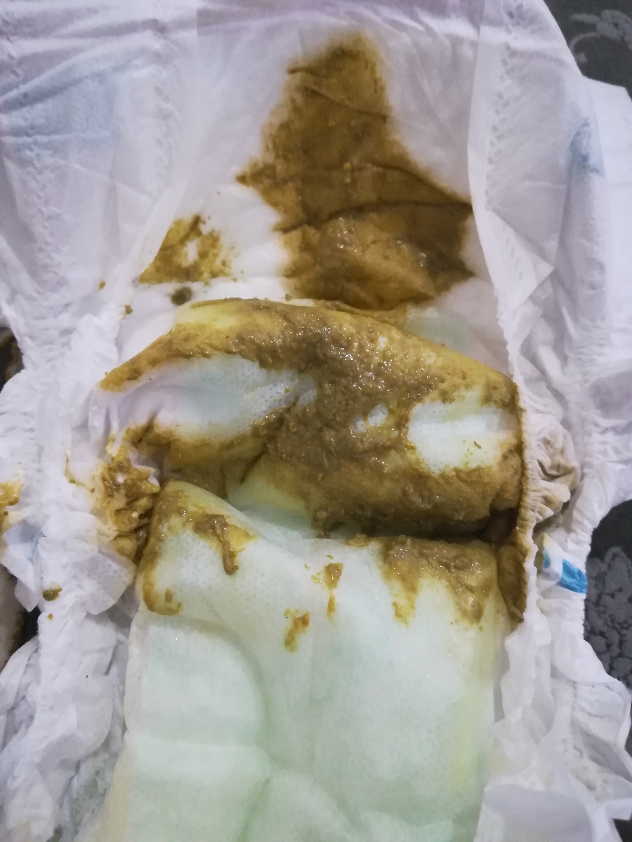 خانم دکتر معذرت میخوام این مدفوع امروزش
قبلا خیلی بو میداد چند روزه اصلا مدفوعش بو نمیده خانم دکتر معذرت میخوام این مدفوع امروزش
قبلا خیلی بو میداد چند روزه اصلا مدفوعش بو نمیده