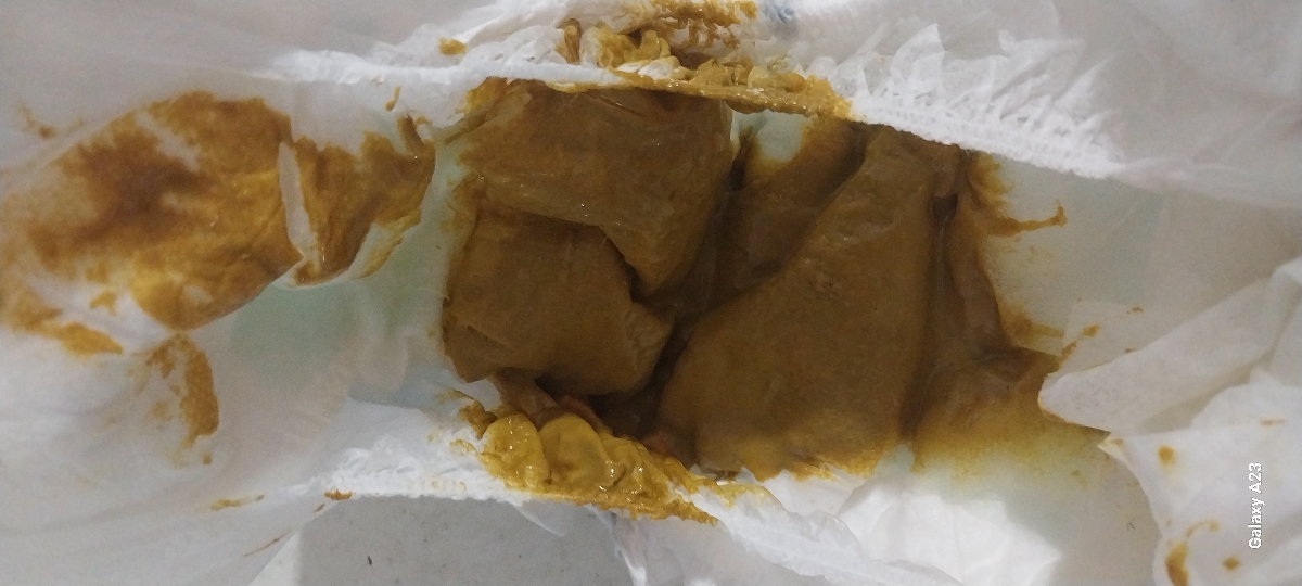 مدفوع نوزاد خلطی است؟ مدفوع نوزاد خلطی است؟