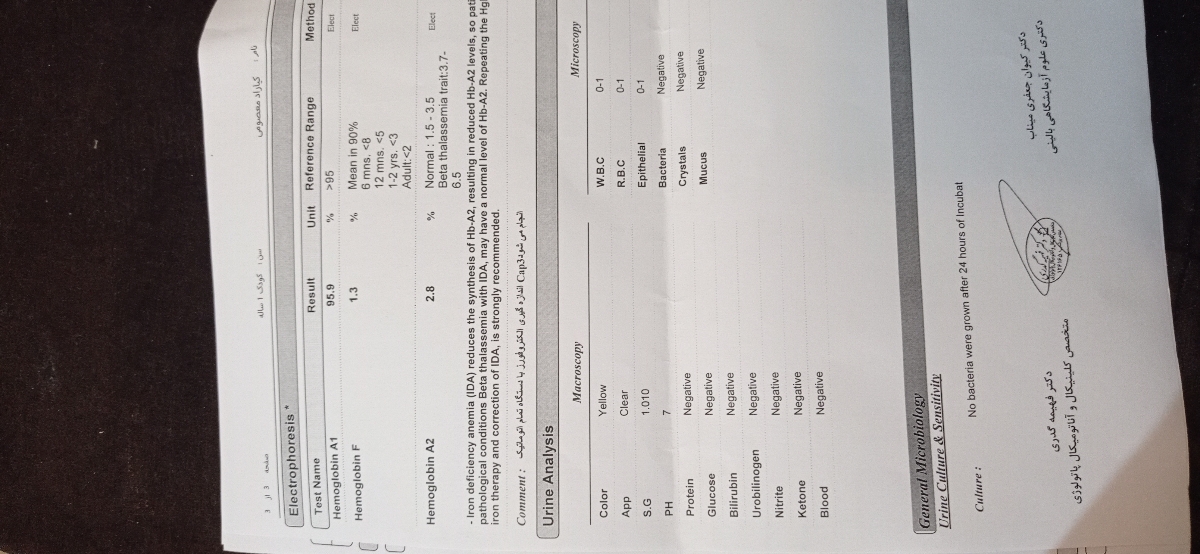 آزمایش چکاب یک‌سالگی