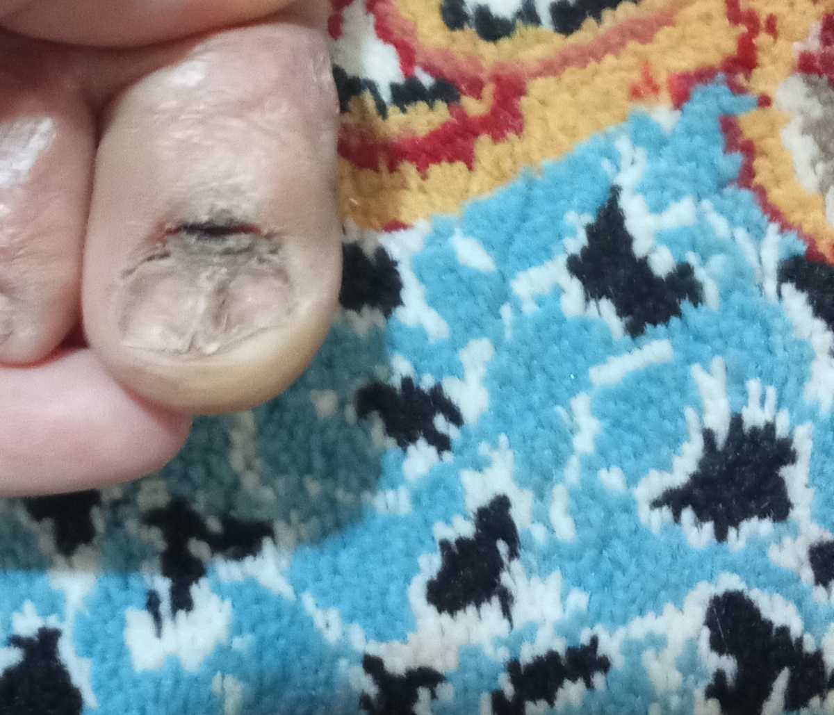 سلام خانومای عزیز لطفا این عکسو نگاه کنی پمادی هست ک خوب بشه سلام خانومای عزیز لطفا این عکسو نگاه کنی پمادی هست ک خوب بشه