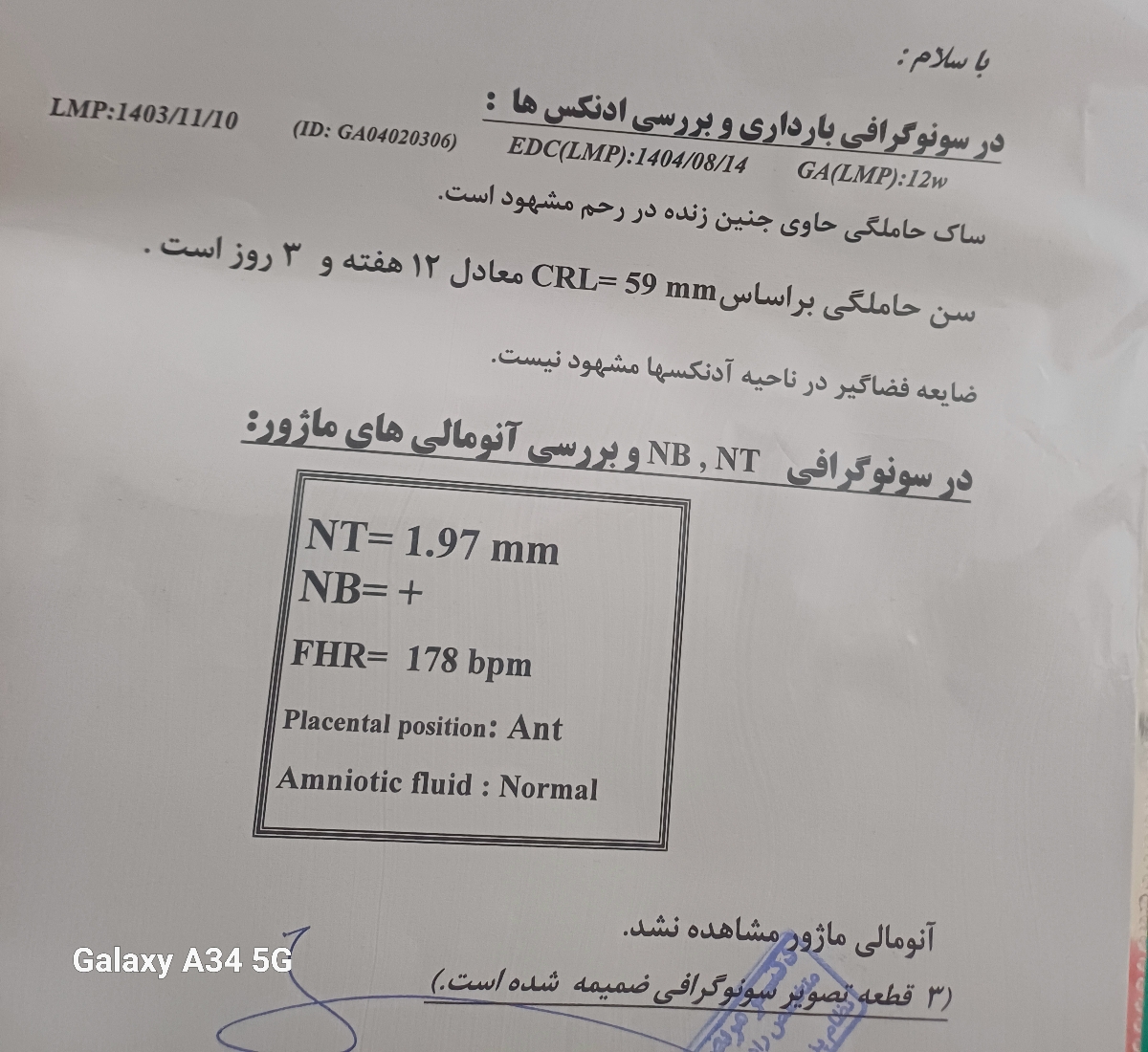 خانم دکتر و دوستان اومایی تو رو خدا هرکی میدونه آزمایش و سونو ان تی رو تفسیر کنه خانم دکتر و دوستان اومایی تو رو خدا هرکی میدونه آزمایش و سونو ان تی رو تفسیر کنه