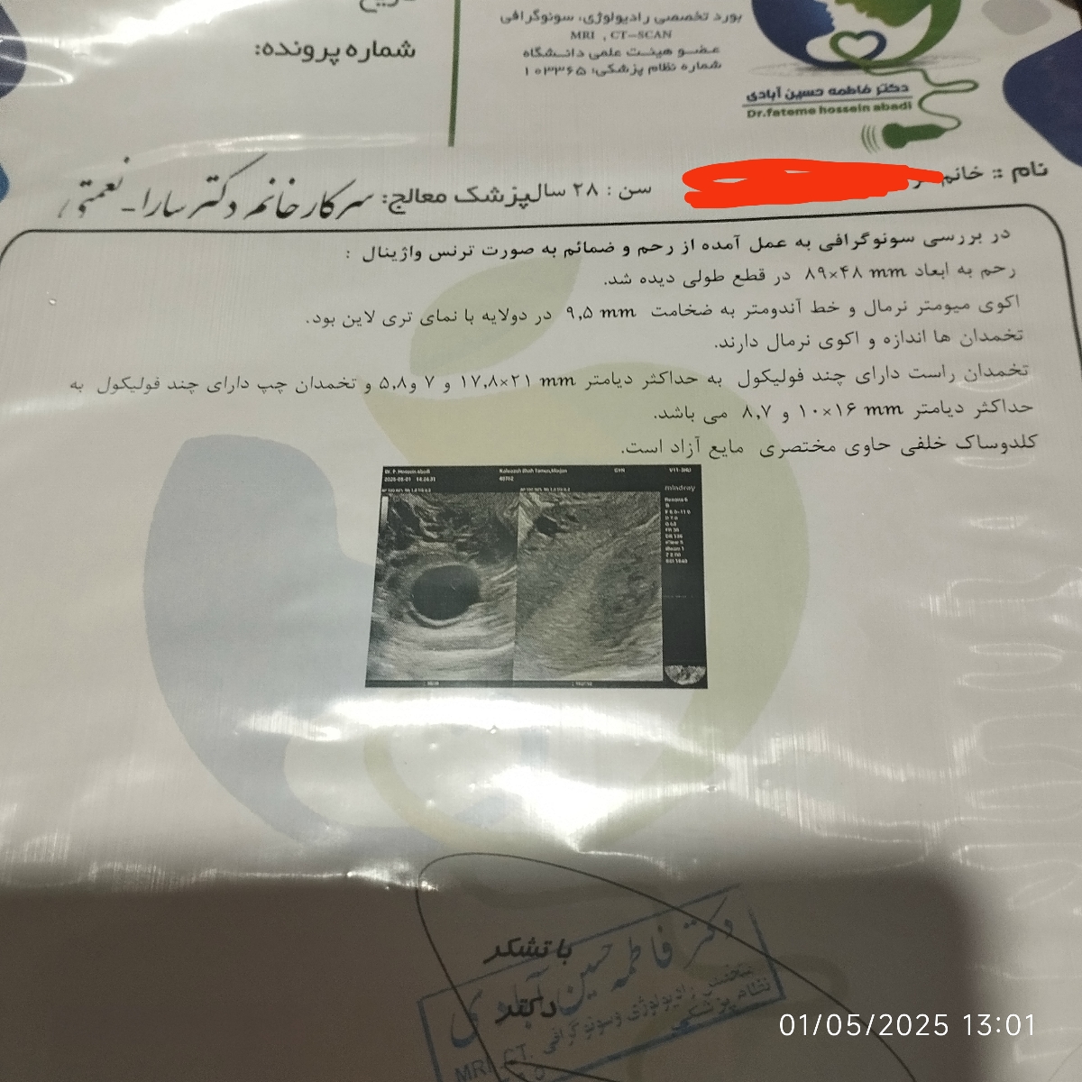 خانم دکتر اقدام به بارداری ومصرف دارو خانم دکتر اقدام به بارداری ومصرف دارو