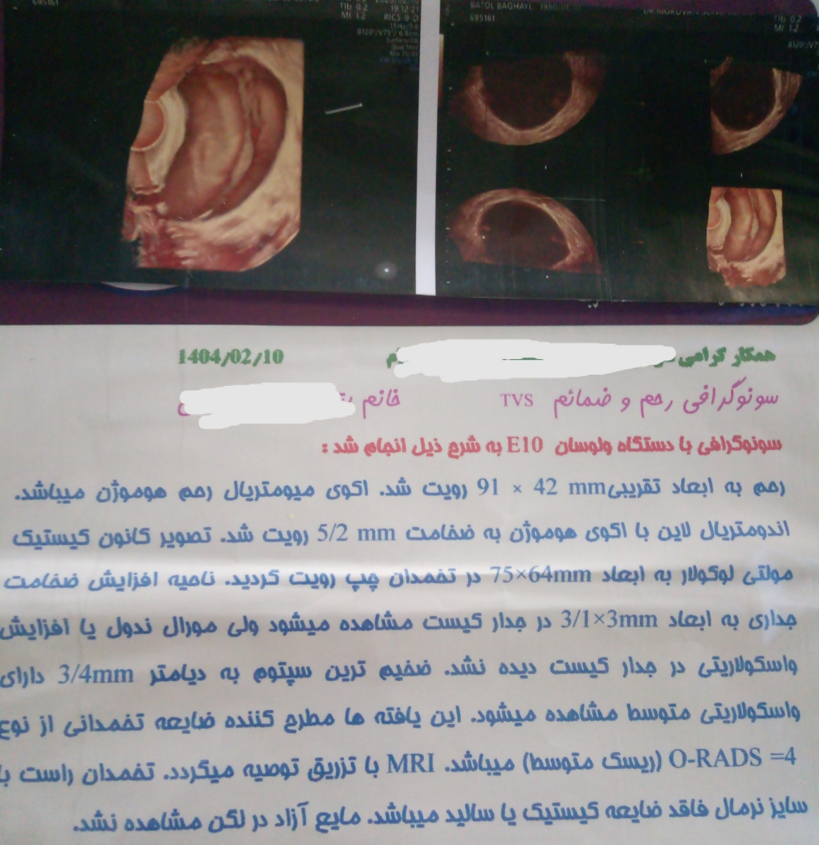 درمان کیست کلیه و مراقبتهاش درمان کیست کلیه و مراقبتهاش