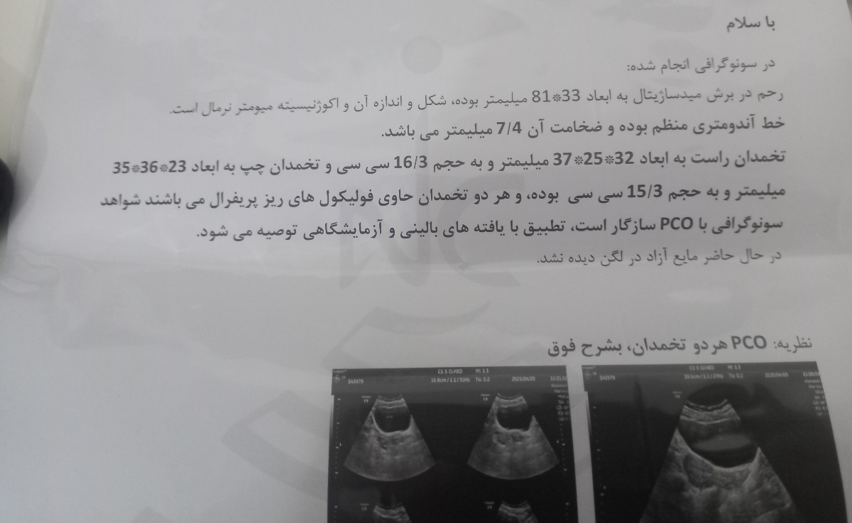 تفسیر آزمایش و سنوگرافی