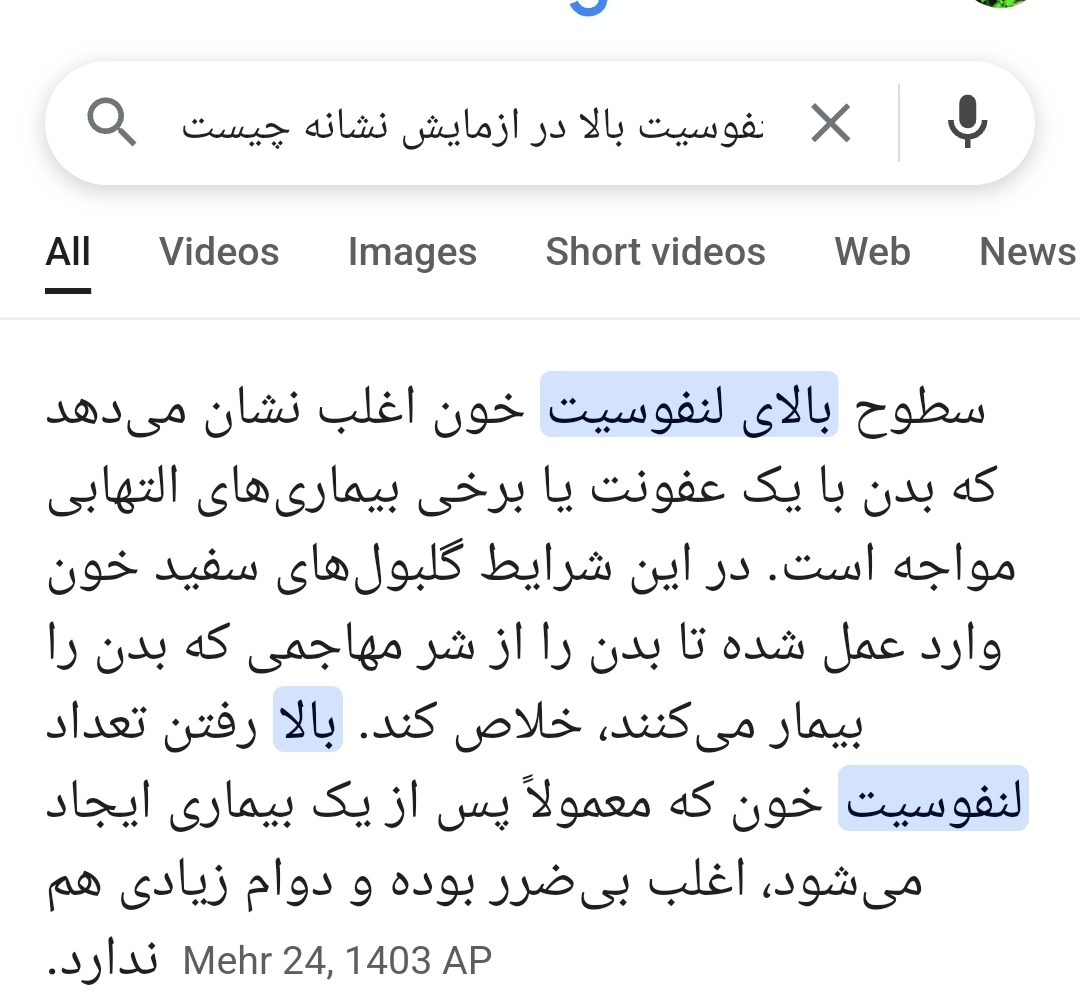 سلام عزیزم تو نت زدم لنفوسیت بالا اینو اورد سلام عزیزم تو نت زدم لنفوسیت بالا اینو اورد