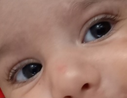 قرینه چشم نوزاد ۶ ماهه قرینه چشم نوزاد ۶ ماهه