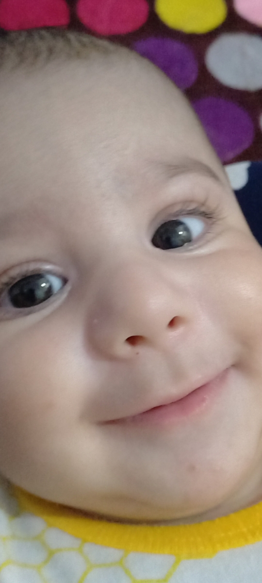 قرینه چشم نوزاد ۶ ماهه قرینه چشم نوزاد ۶ ماهه