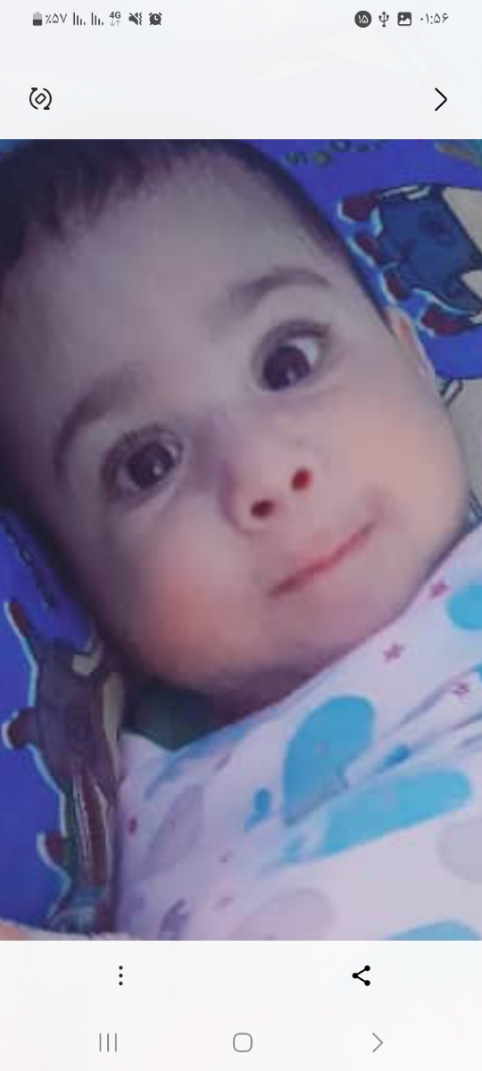 قرینه چشم نوزاد ۶ ماهه قرینه چشم نوزاد ۶ ماهه