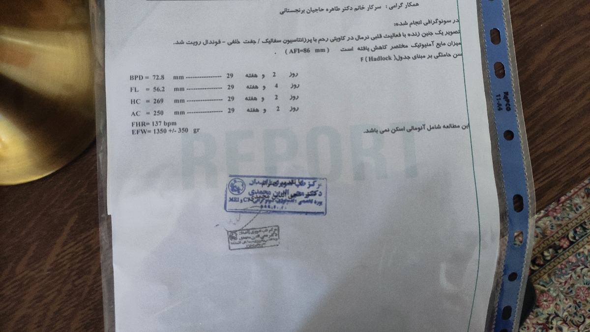 آب دور جنین آمینوتیک آب دور جنین آمینوتیک