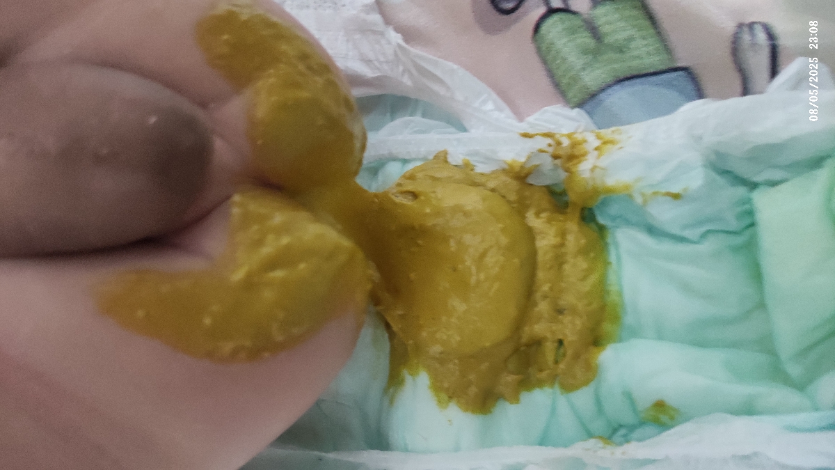 ایا این مدفوع نوزاد خلطی است؟