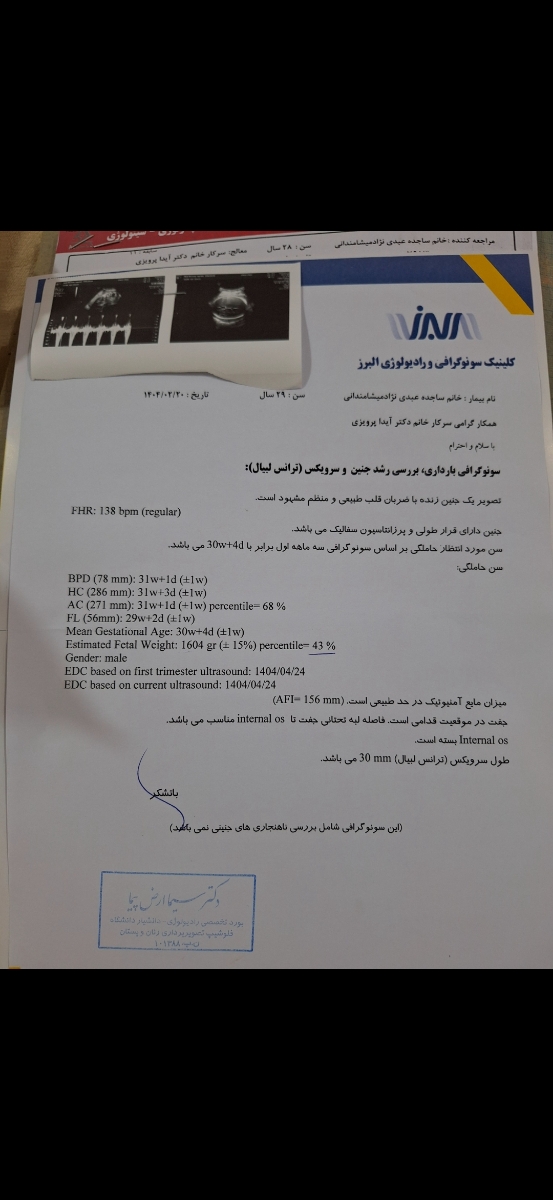 خانم دکتر سونو وزن جنین خانم دکتر سونو وزن جنین