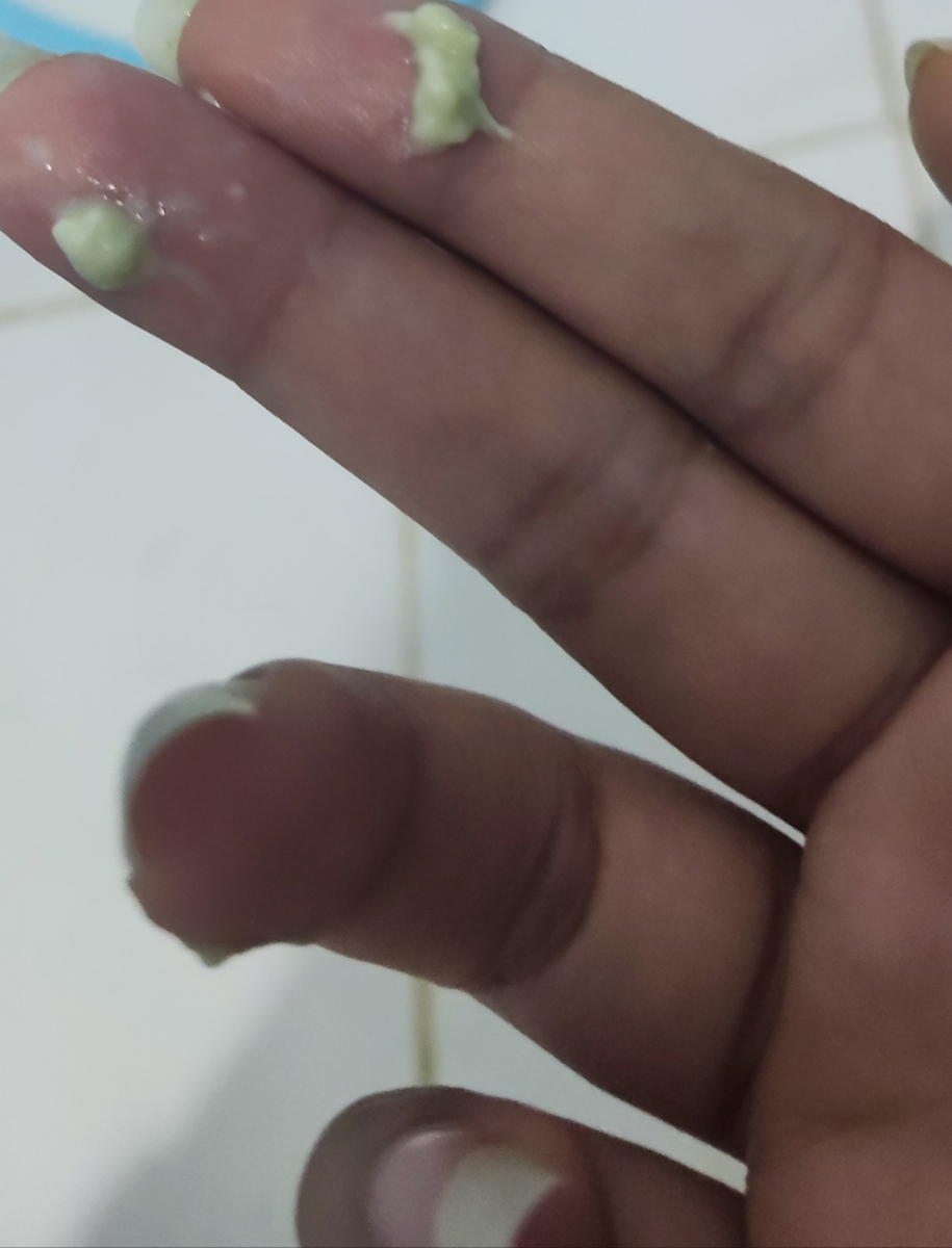 ترشحات زیاد در ماه هفتم ترشحات زیاد در ماه هفتم