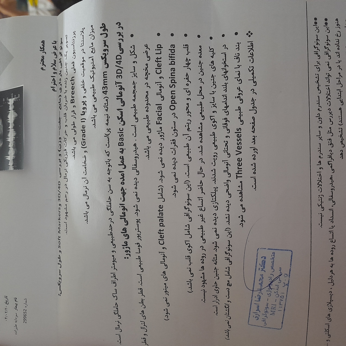 پایین بودن جفت و پرویا در سونو آنومالی پایین بودن جفت و پرویا در سونو آنومالی